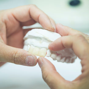 技工物の制作イメージ